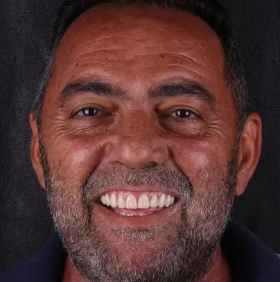 Retrato de um paciente homem sorrindo após o tratamento, fotografado em estúdio sobre fundo escuro
