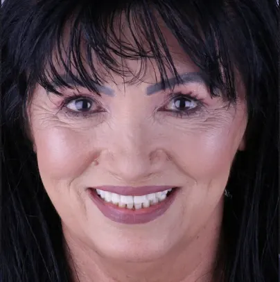 Retrato de uma paciente de cabelos escuros sorrindo após o tratamento, em estúdio sobre fundo escuro