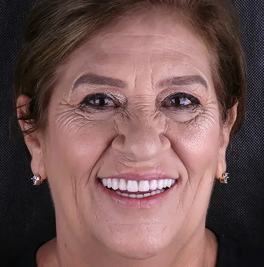 Retrato de uma paciente sorrindo após a reabilitação, em estúdio sobre fundo escuro